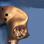 Torino, primo trapianto mondiale di bacino